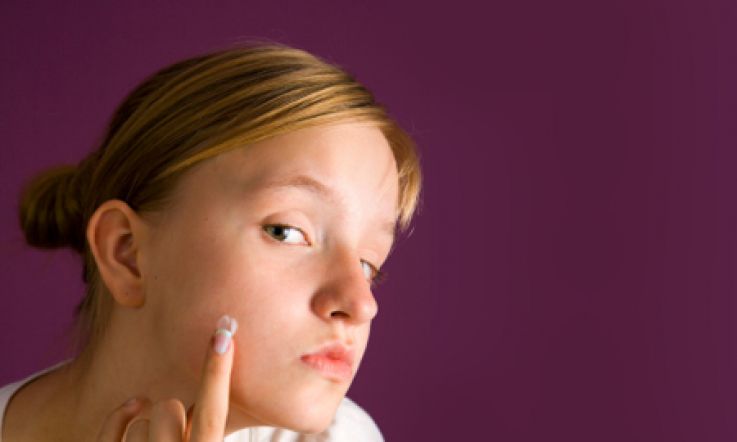 Adult Acne: What Causes it?