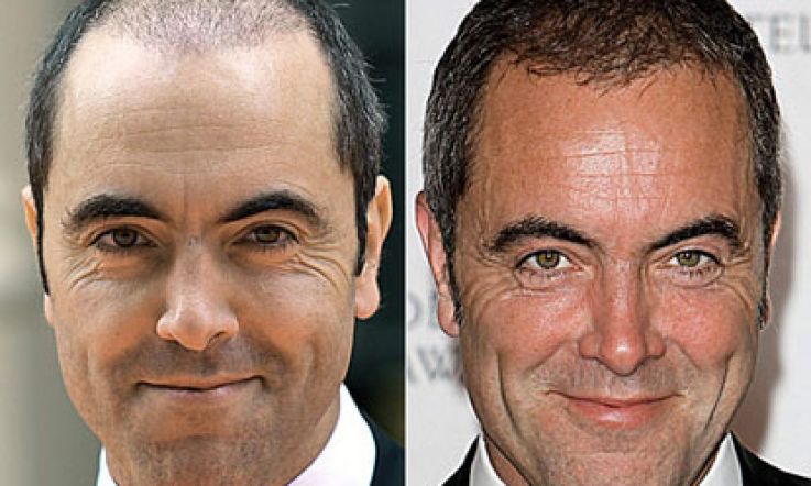 James Nesbitt gets a new head of hair: is refreshingly honest about the whole procedure