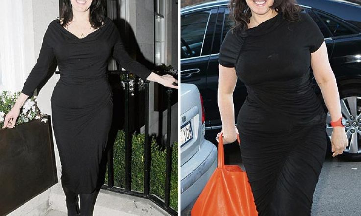 Celebrity weight loss: gastric band or diet?
