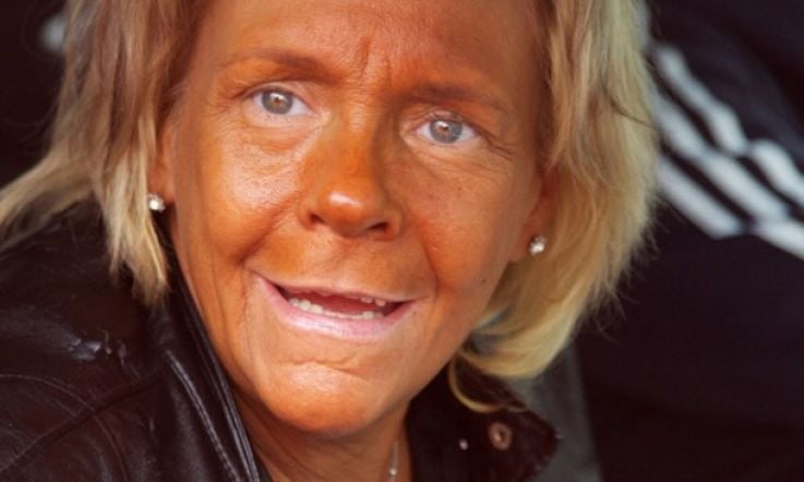 Lets learn from Tanning Mom: sunbed use in Ireland off the scale. Do you know a tanorexic?