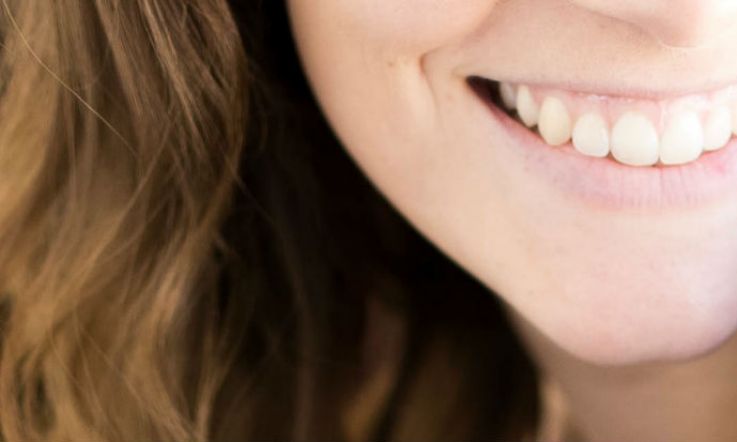 What happened when this teeth whitening newbie tried a professional kit?