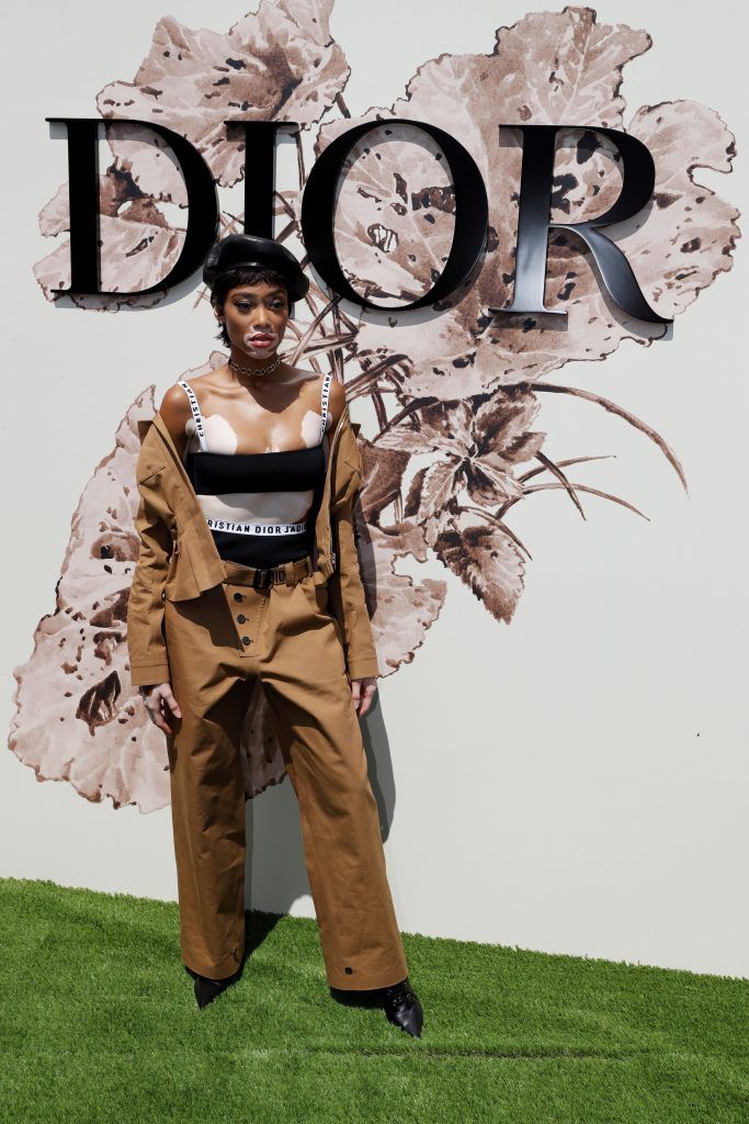 Canadian model Winnie Harlow poses during the photocall before Christian Dior 2017 fall/winter Haute Couture collection show in Paris on July 3, 2017. (Photo by Patrick Kovarik/AFP/Getty Images)