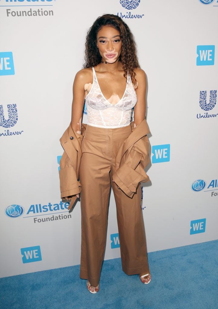 Model Winnie Harlow attends WE Day California to celebrate young people changing the world at The Forum on April 27, 2017 in Inglewood, California.  (Photo by Jesse Grant/Getty Images for WE)
