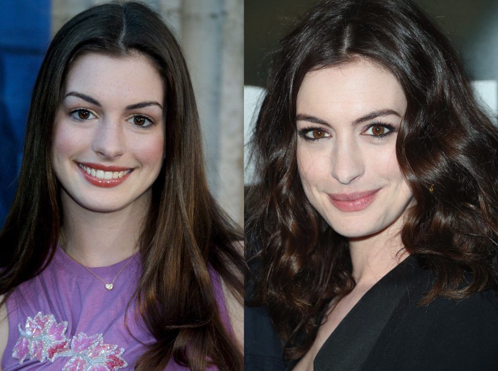 Anne Hathaway in 2001, aged 19, and in 2017, aged 34. (Photos by Frederick M. Brown/Getty Images)