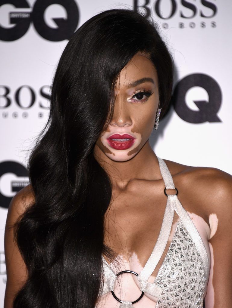 LONDON, ENGLAND - SEPTEMBER 05:  Winnie Harlow attends the GQ Men Of The Year Awards at the Tate Modern on September 5, 2017 in London, England.  (Photo by Gareth Cattermole/Getty Images)