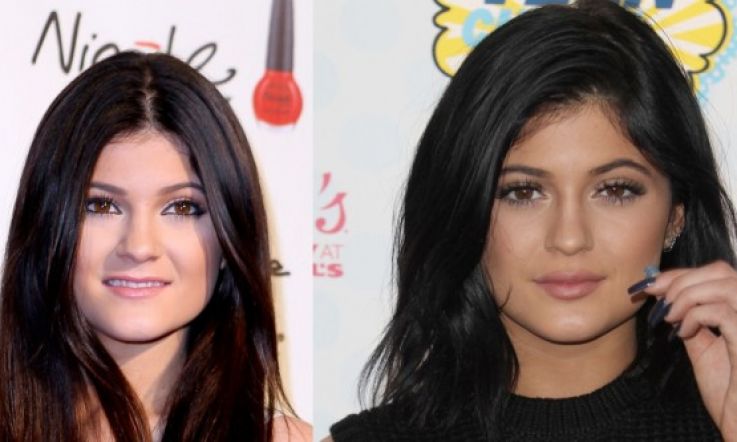 Lowdown on Lips: How IS Kylie Jenner Doing That? We Show You How to Pump Up the Pout