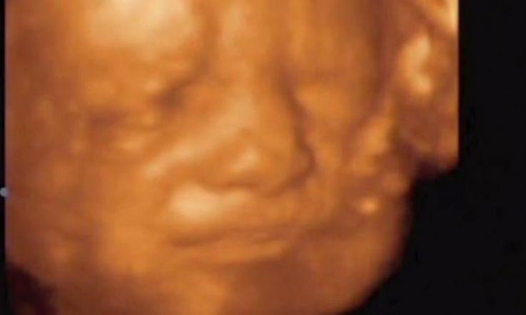 Baby in the Womb was Caught Living Life and It's Amazing!