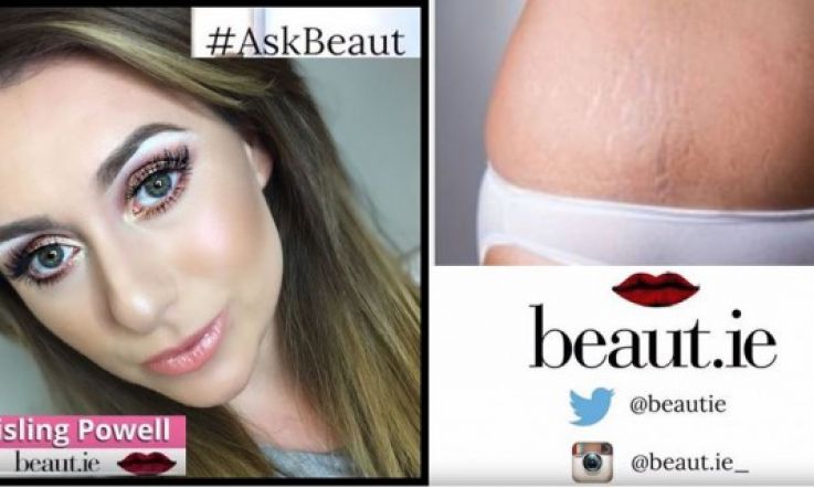 Ask Beaut: How do I get rid of stretch marks?