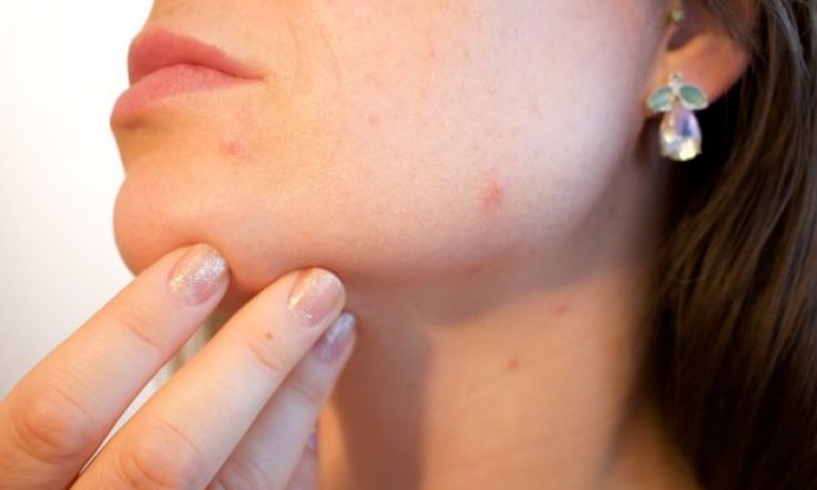 3 simple and gross reasons that your skin might be breaking out