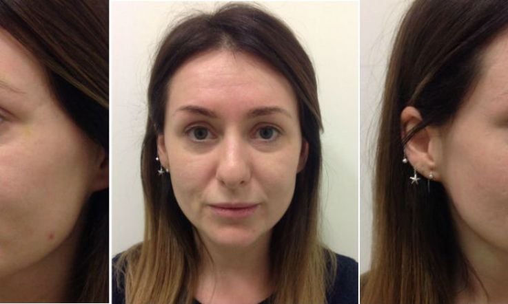 Life without makeup: What happens during an intense skin consultation