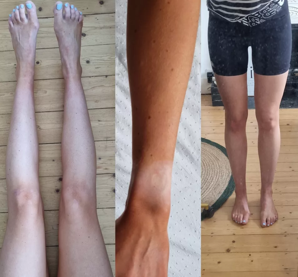 Before and after pictures of Skinny Tan's Whipped Peach Foam