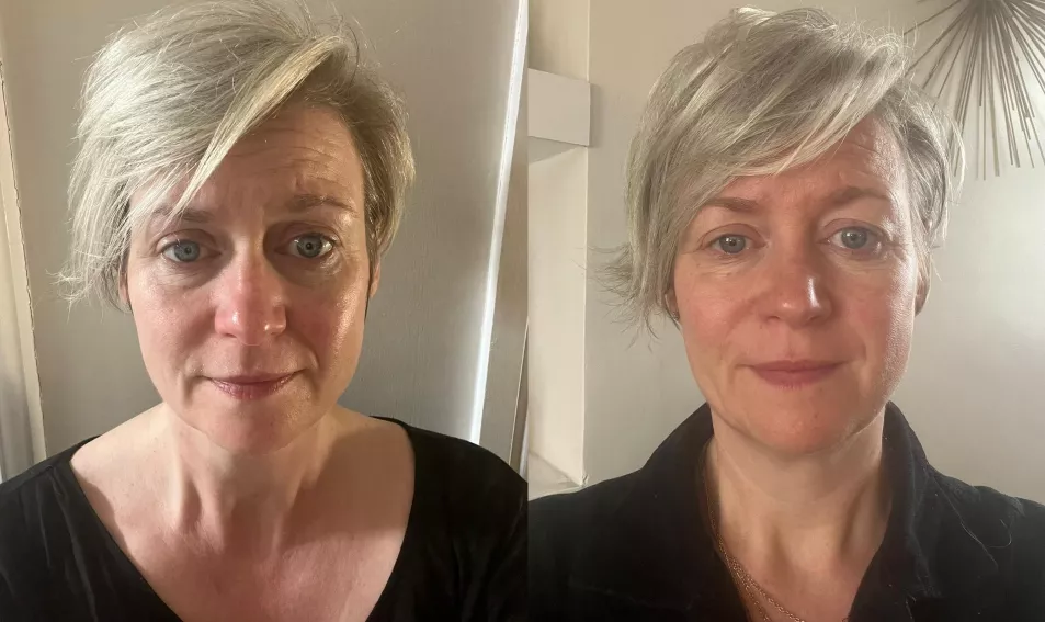Before and after photos of Skinny Tan's Face Mist