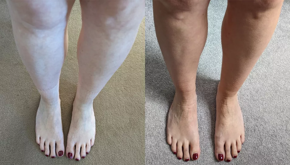 before and after using Vita Liberata Tanning mist