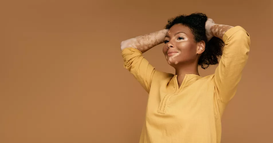 A lady with vitiligo smiling into the distance holding her hair up wearing a yellow long sleeve top