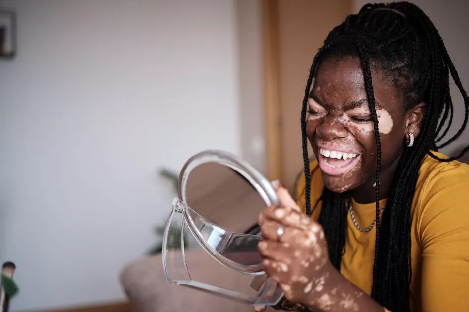 Cheerful African American woman with vitiligo holding mirror