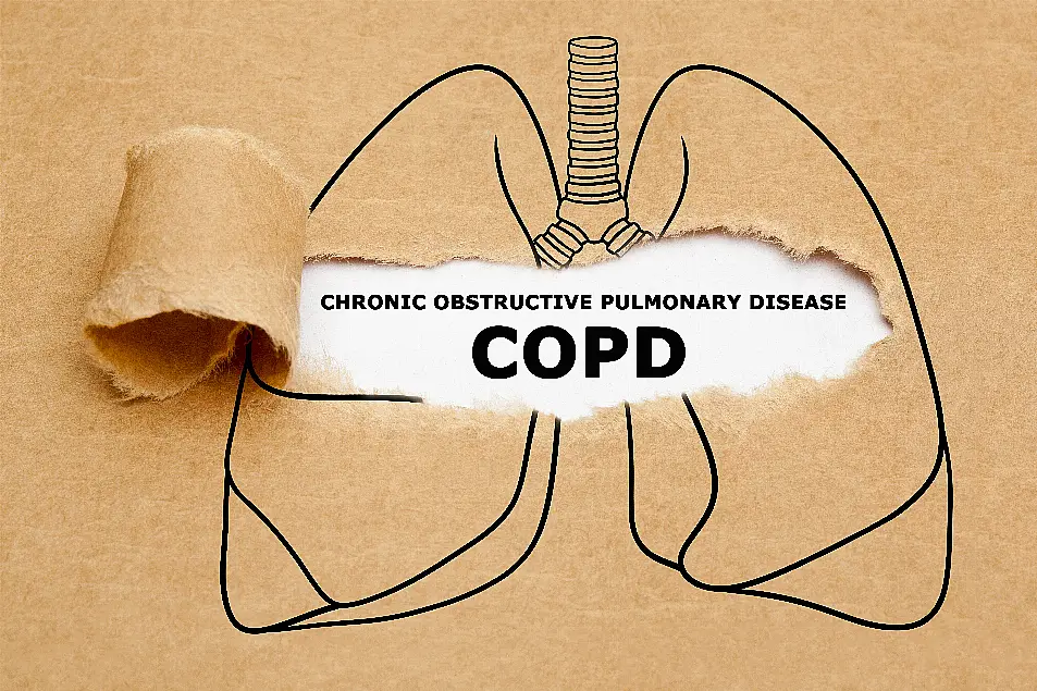 A drawing of a lung with the word COPD written on it