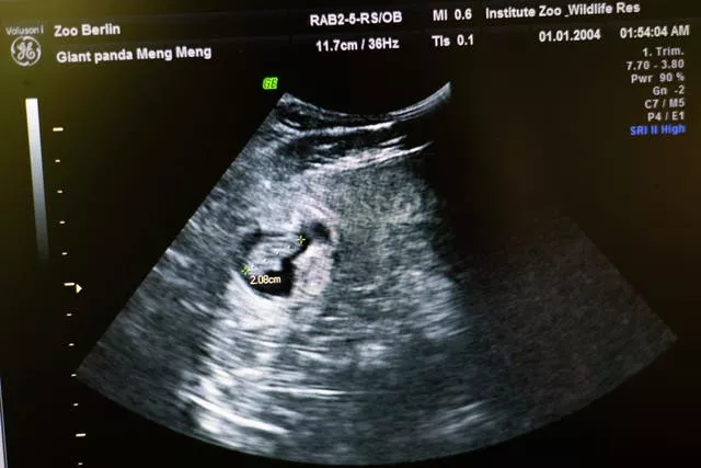 An embryo inside Meng Meng, seen on an ultrasound scan