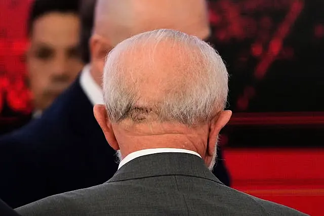 The back of President Lula's head shows stitches resulting from a fall 