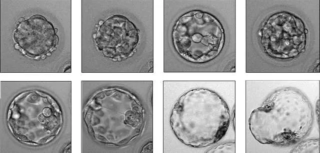 Embryo breakthrough ‘may cut multiple IVF births