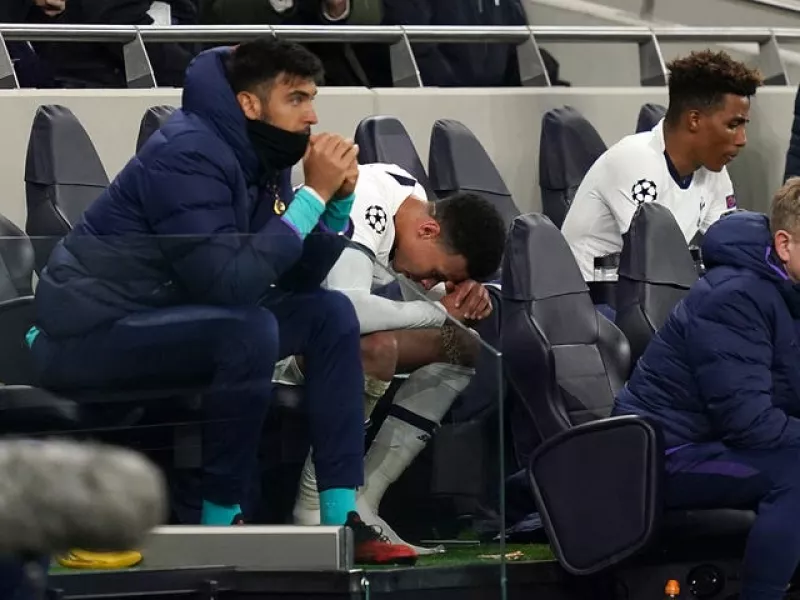 Dele Alli has had to fight for appearances for Tottenham this season and has often found himself on the bench