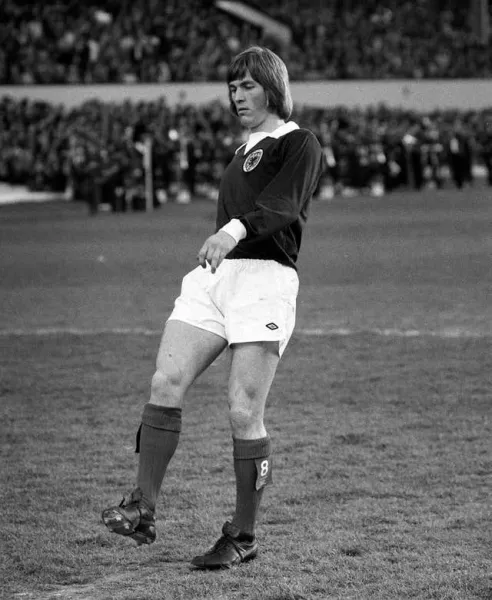 Kenny Dalglish playing for Celtic