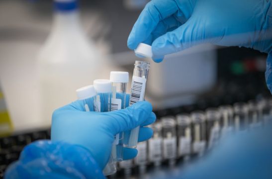 Demand For Pcr Testing Of Employees Has ‘Sky-Rocketed,’ Provider Says