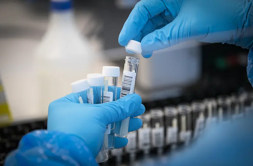 Demand For Pcr Testing Of Employees Has ‘Sky-Rocketed,’ Provider Says