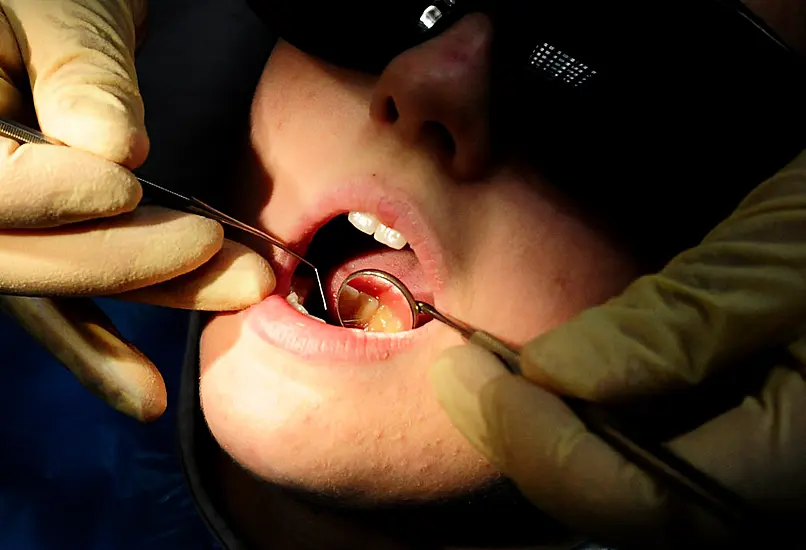 Medical Card Patients Dental Scheme 'Collapsing Rapidly'