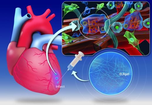 Researchers In Ireland Develop Gel To Repair Heart Muscle After Heart Attack