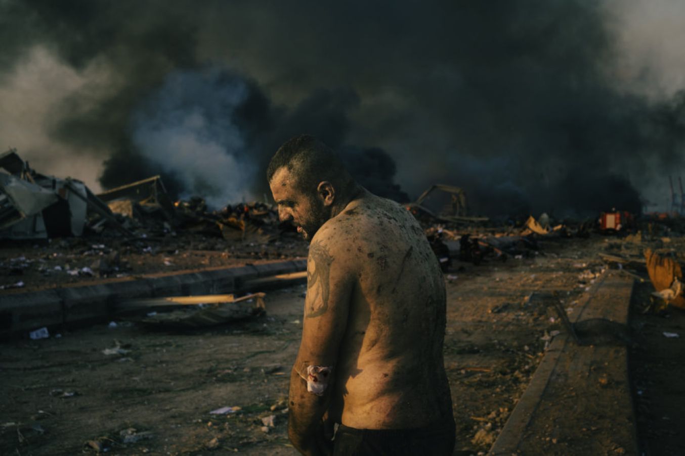 An Injured Man Stands Near The Site Of A Massive Explosion In The Port Of Beirut, Lebanon In August. Lorenzo Tugnoli, Italy, Contrasto For The Washington Post.