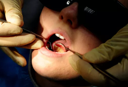Rise In Cosmetic Dental Work ‘Off The Richter Scale’ Since Onset Of Covid