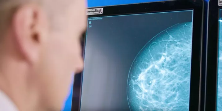 Artificial Intelligence Set To Assist Breast Screening In Ireland