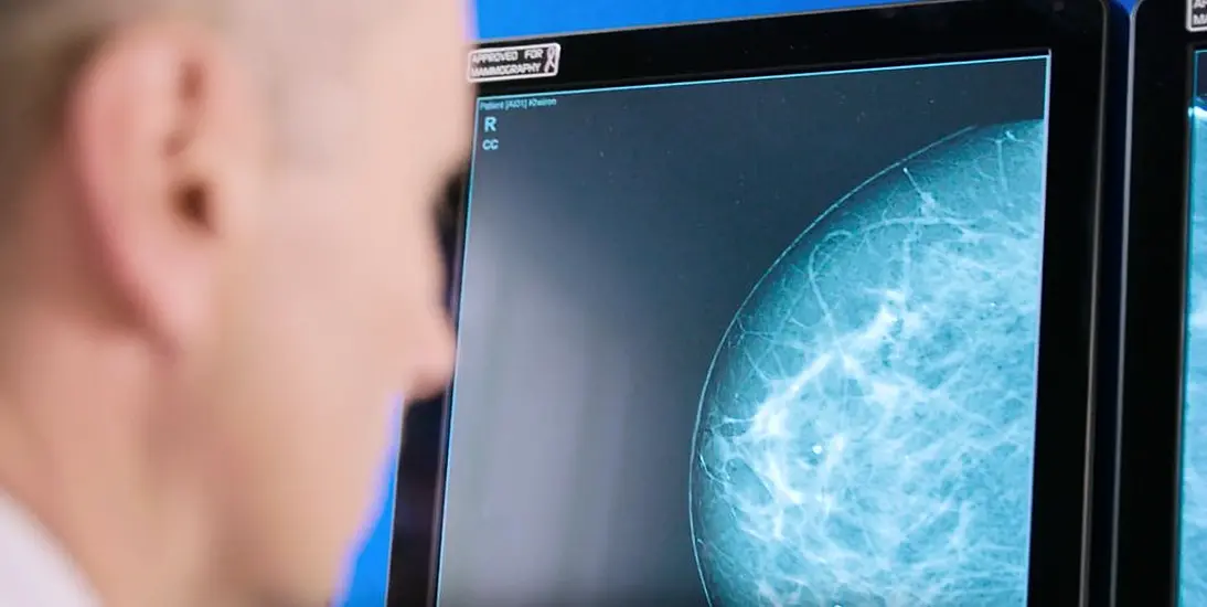 Artificial Intelligence Set To Assist Breast Screening In Ireland