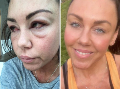 Michelle Heaton Shares Transformation Photos To Mark National Sober Day