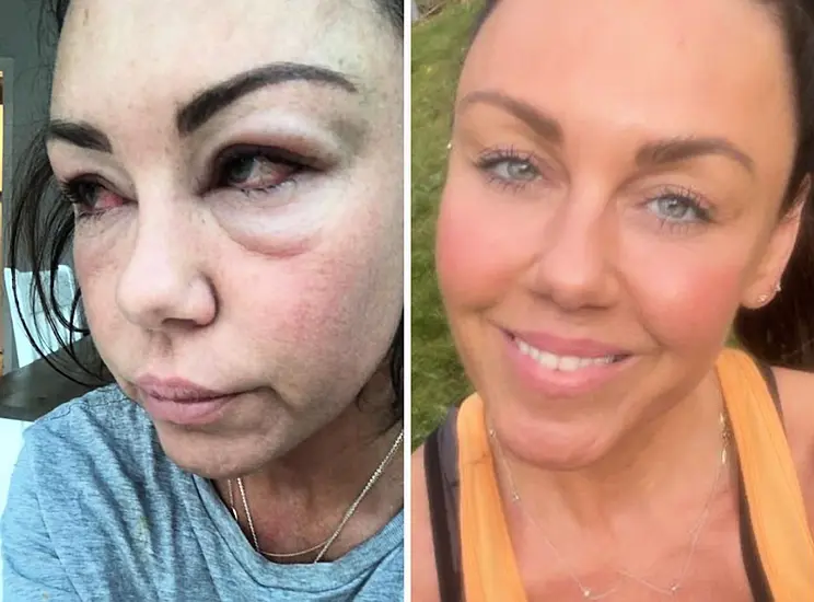 Michelle Heaton Shares Transformation Photos To Mark National Sober Day