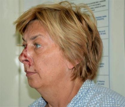 Croatian Police Identify Woman Found With Memory Loss On Adriatic Island