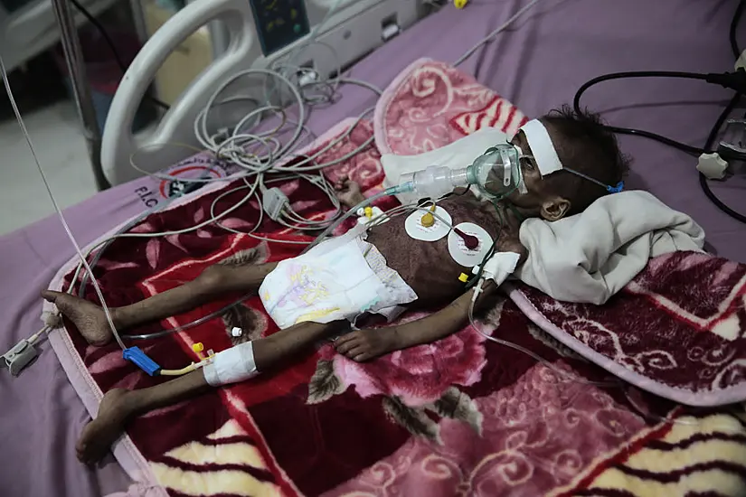 Millions Facing Starvation In Yemen, Un Food Agency Warns