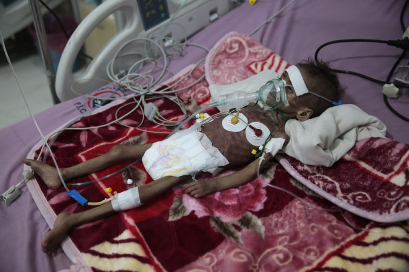 Millions Facing Starvation In Yemen, Un Food Agency Warns