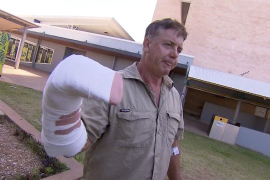 Australian Tour Operator Has Lucky Escape In Crocodile Attack
