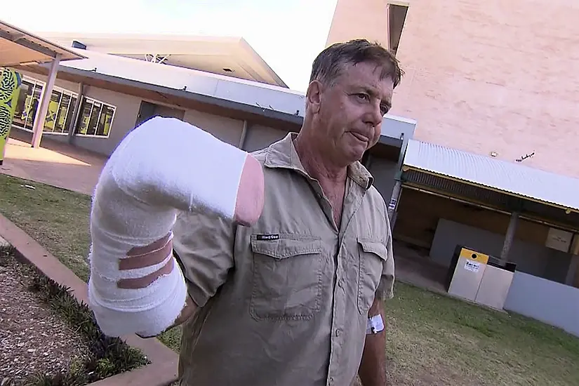 Australian Tour Operator Has Lucky Escape In Crocodile Attack