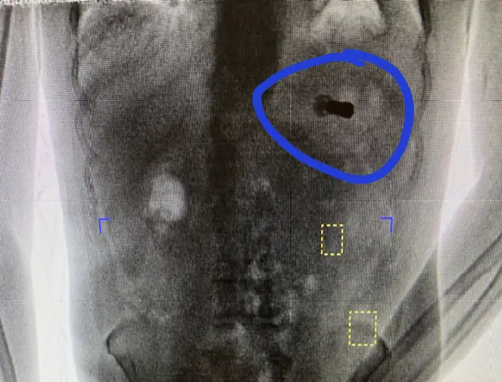 Body Scan Reveals Shotgun Shell Inside Prisoner