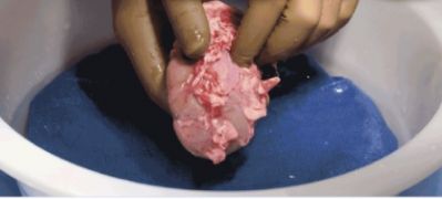 Pig Kidney Successfully Transplanted Into A Human For The First Time