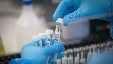 Omicron Cases &#039;Substantially Higher&#039; Than Recorded Due To Pcr Test Challenges