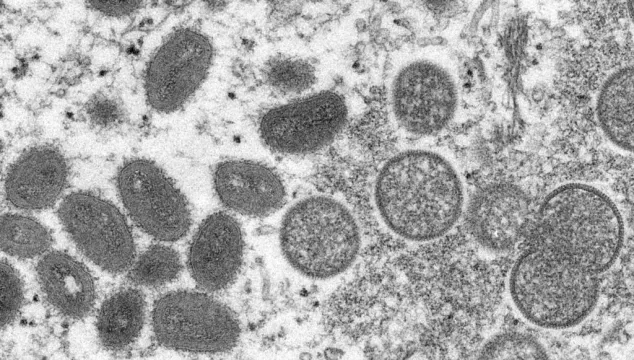 Us Reports Case Of Monkeypox Amid Number Of Small Outbreaks In Europe