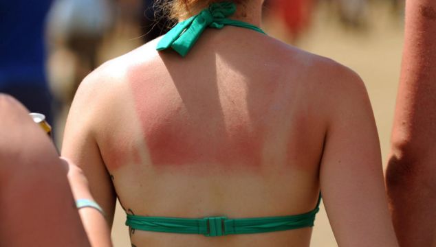 Suncream And Sunburn: How To Protect Yourself