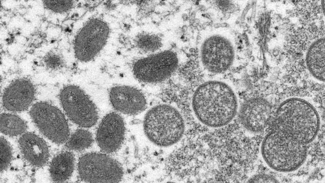 Monkeypox: 97 Cases Confirmed In Ireland