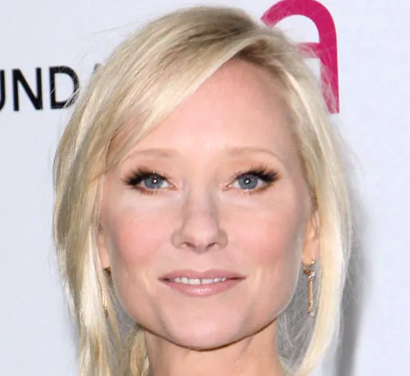 Anne Heche Reportedly In Critical Condition Following La Vehicle Collision