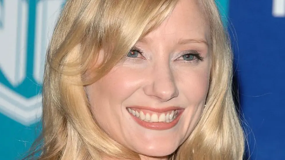 Hollywood Star Anne Heche In A Coma After La Car Crash