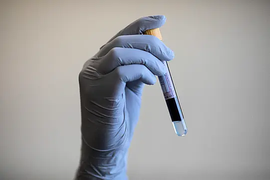 Blood Test 'Could Detect Breast Cancer Up To Two Years Before Diagnosis'