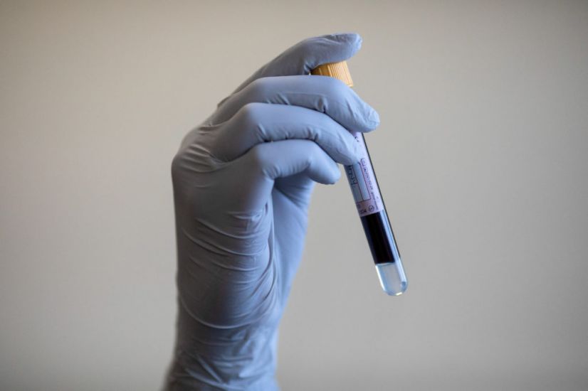 Blood Test 'Could Detect Breast Cancer Up To Two Years Before Diagnosis'